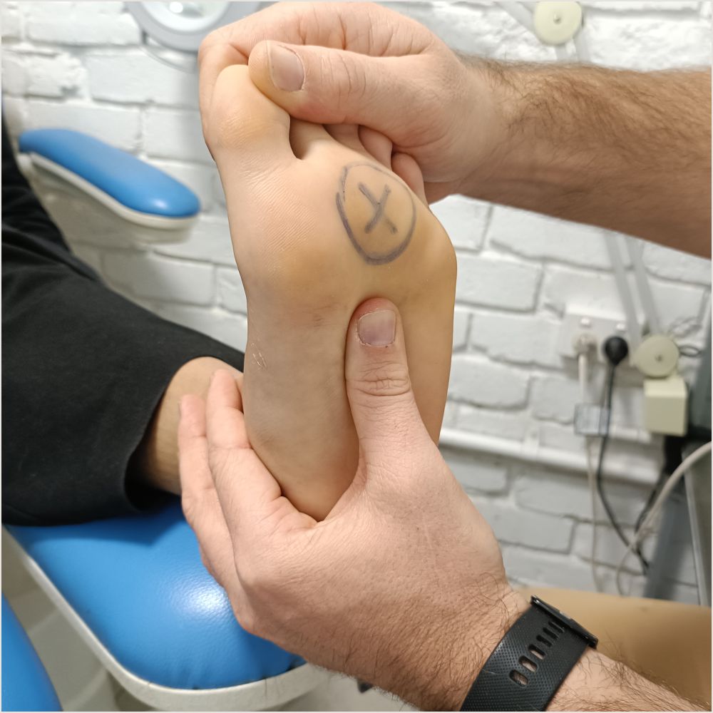 Bursitis pain relief